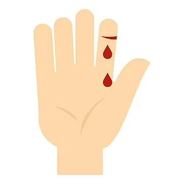 Wound Healing