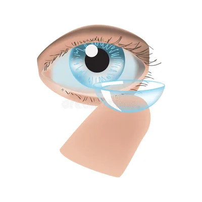 Lens Solution