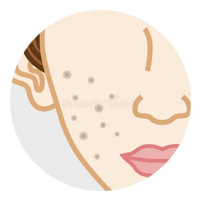 Pore Refiner