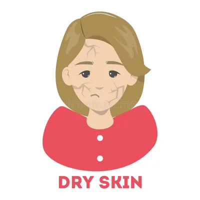 Dry Skin