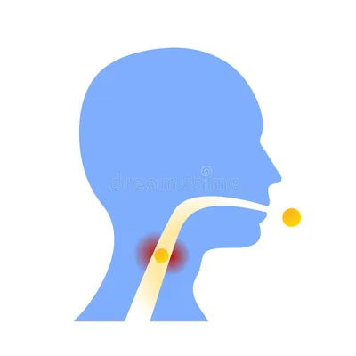 Throat Spray